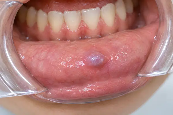 vydalennia-novoutvoren-i-katehorii-1